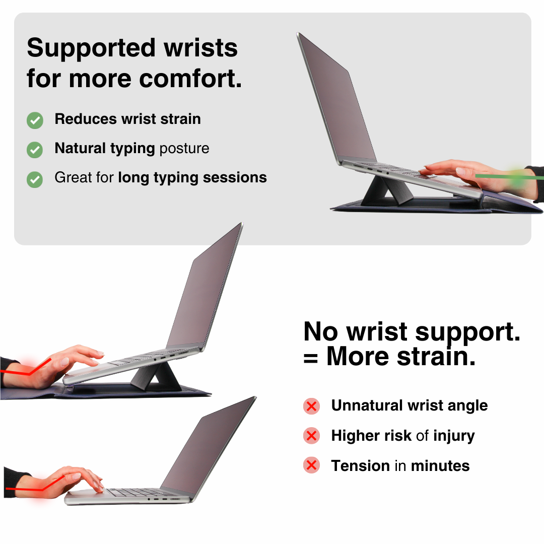 SMART SLEEVE