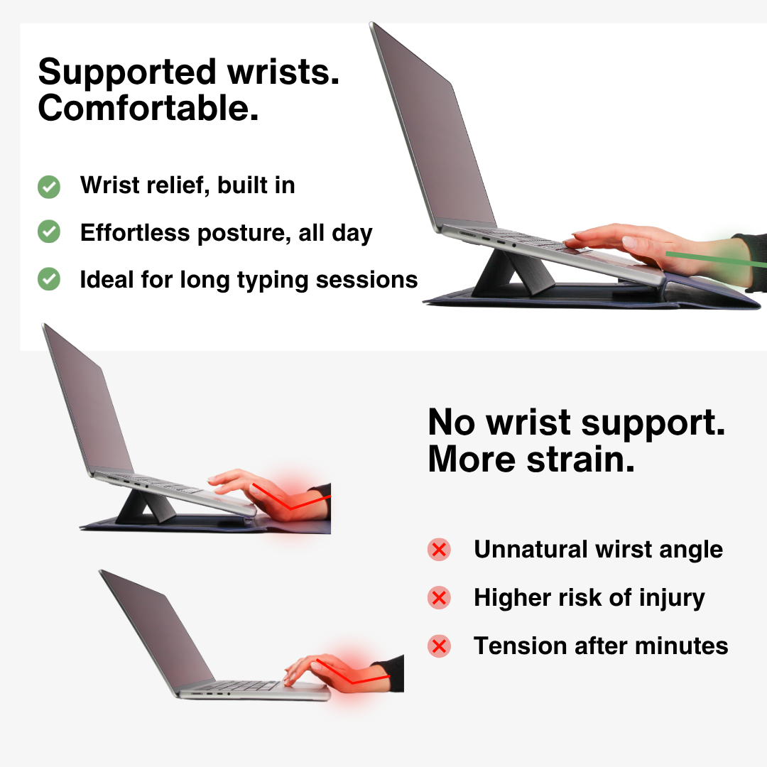 SMART SLEEVE® – 4-in-1 Ergonomic Workstation Set